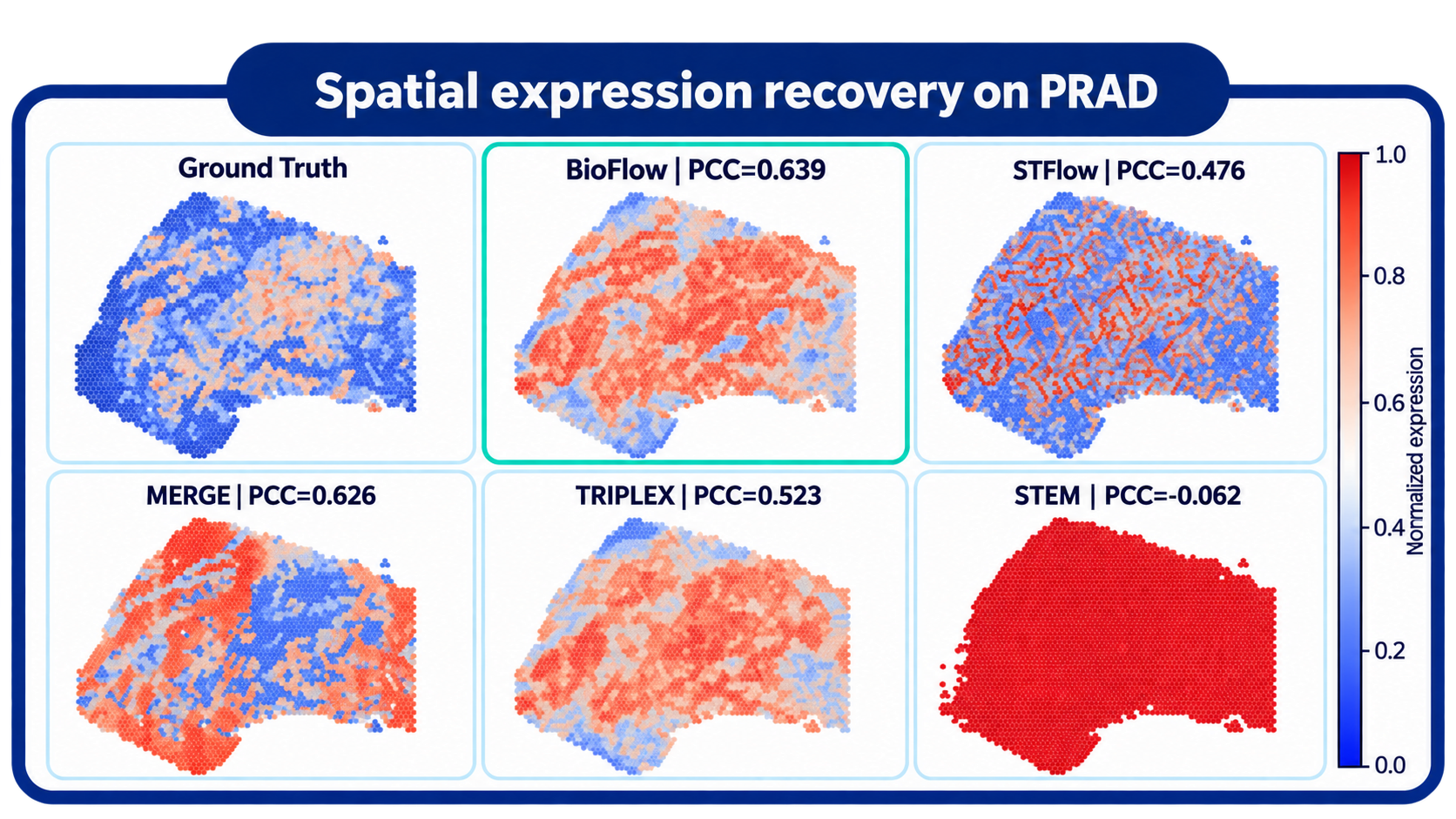 Spatial expression recovery for AMD1 on PRAD