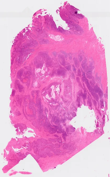 Low-resolution H&E whole-slide image of COAD TENX111 tissue